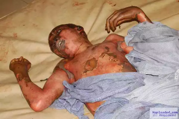 Graphic Photo: 22-year-old Man Dies after Father Tied Him Up & Set Him Ablaze in Kwara